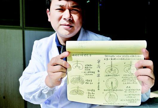 医生手绘18幅手术“秘籍”走红 耗时月余